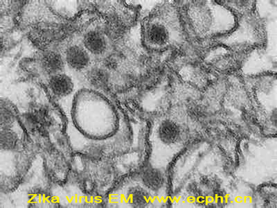 Zika virus EM