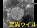 英国变异病毒感染力比以往病毒平均高出1.32倍