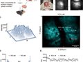《科学》刊文：血液中的微塑料可引起细胞阻塞而诱发脑血栓，并导致神经行为异常